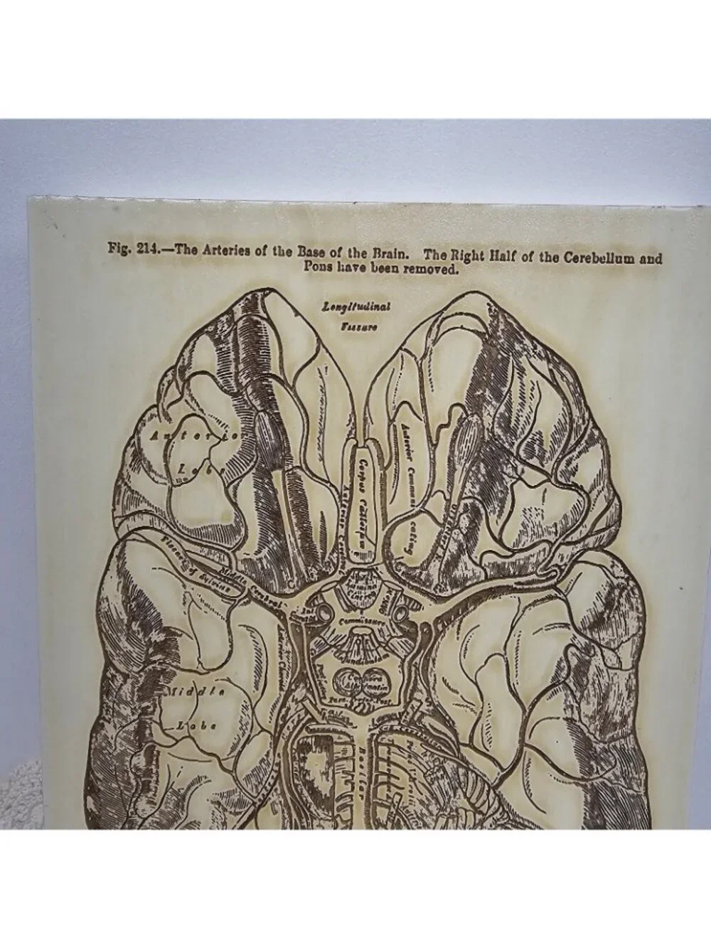 Vintage Gray’s Anatomy Brain Arteries Wood Wall Plaque Medical Art Doctor Gift